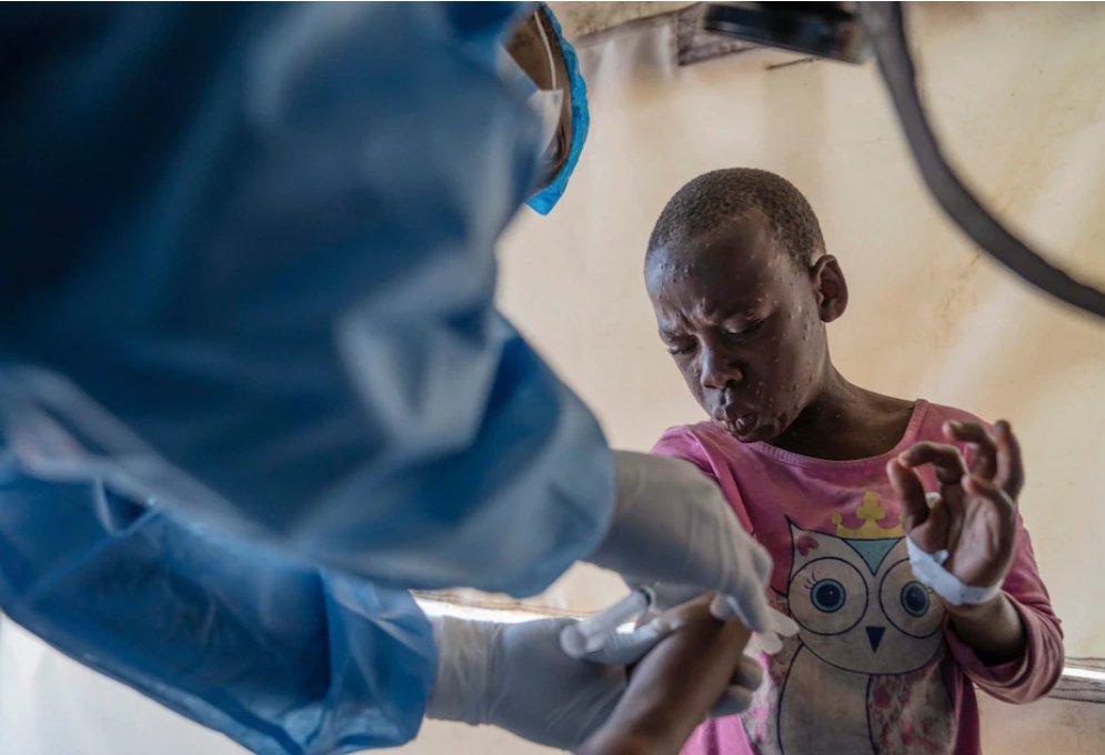 100-people-die-from-mpox-in-Africa