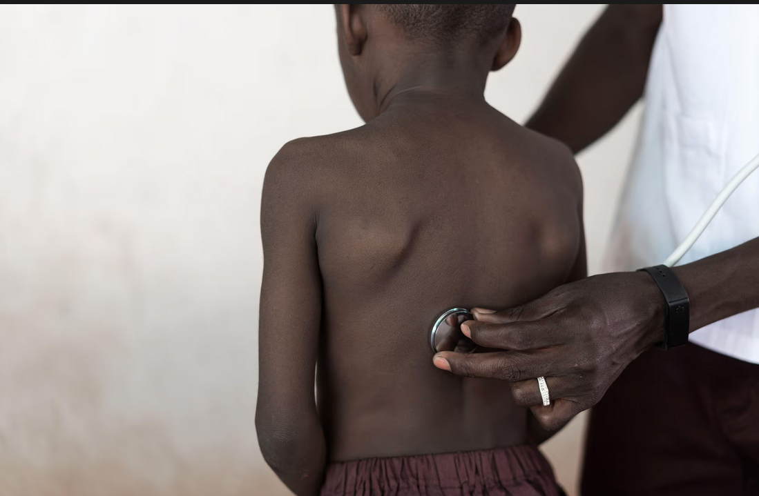 Millions of teenagers in Africa have undiagnosed asthma